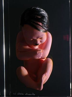 Artwork Title: Adolf foetus