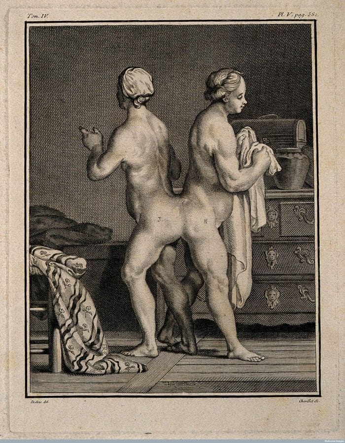 Artwork Title: Hélène and Judith, siamese twins known as The Hungarian Sisters