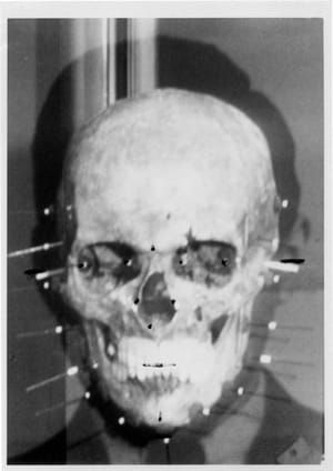 Artwork Title: Burden of Proof of skull of Mengele