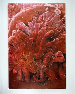 Artwork Title: Biopsy Paintings:  Small Intestine