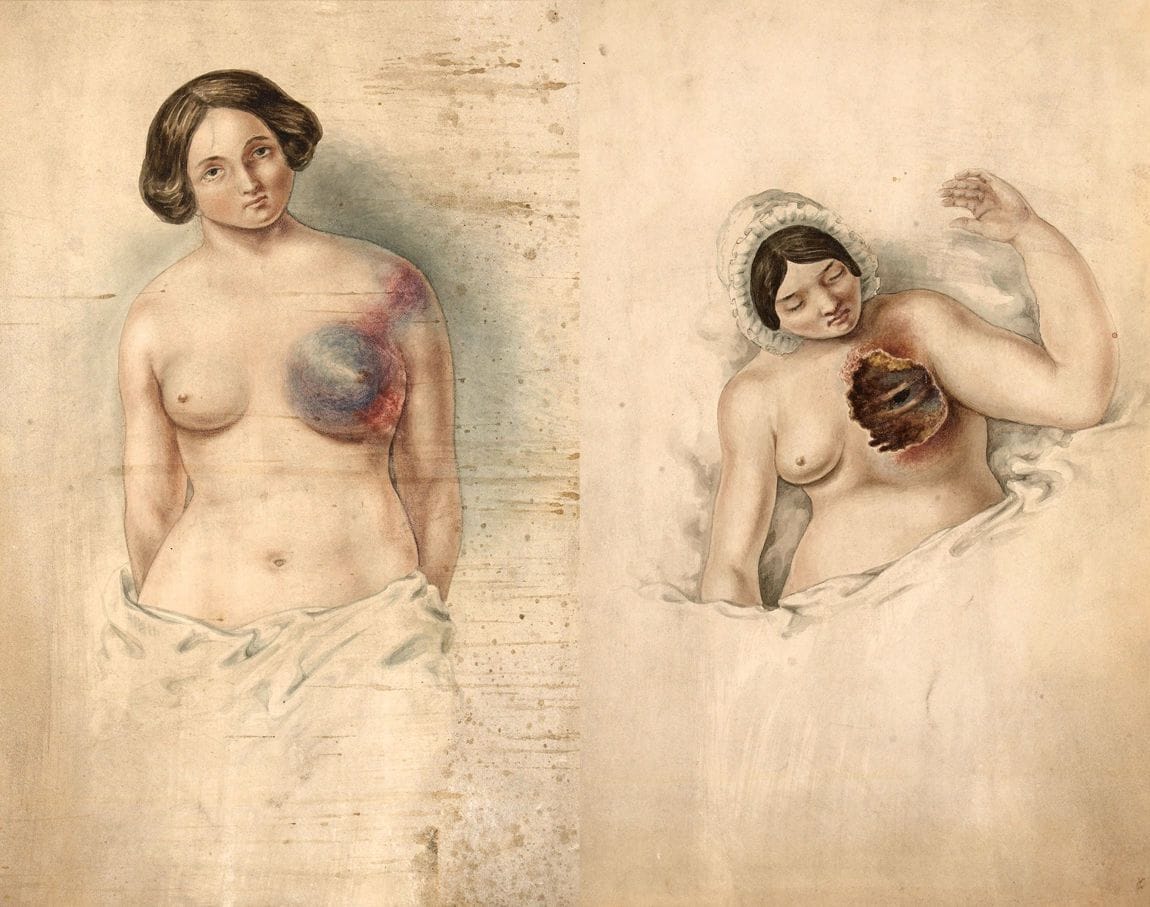 Artwork Title: undefined