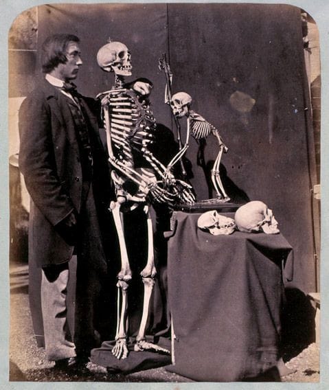 Artwork Title: Reginald Southey and Skeletons