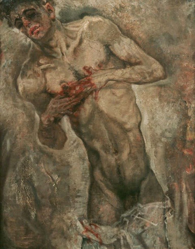 Artwork Title: Bleeding Man