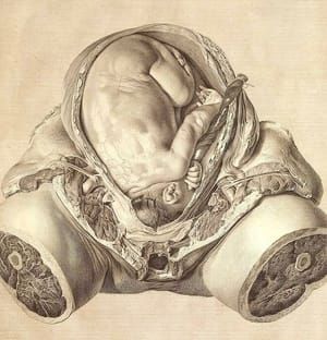 Artwork Title: Anatomy of late pregnancy. Plate VI of The Anatomy of the Human Gravid Uterus
