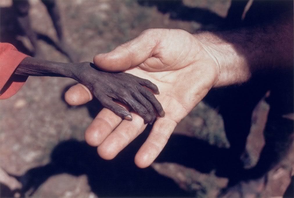 Artwork Title: Starving child and missionary, Uganda