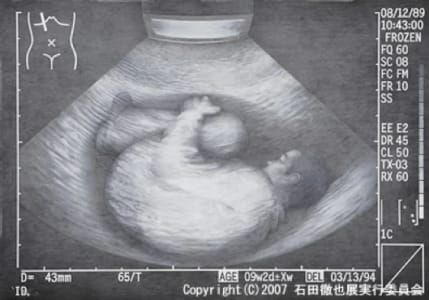 Artwork Title: Untitled