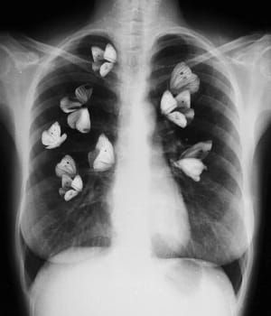 Artwork Title: Untitled