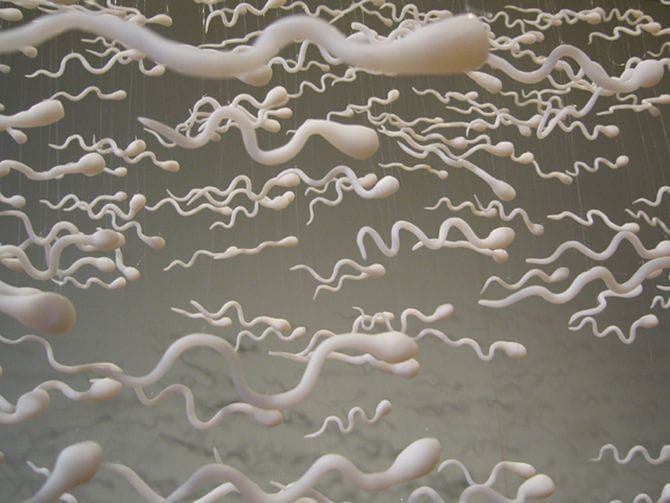 Artwork Title: Spermatozoides