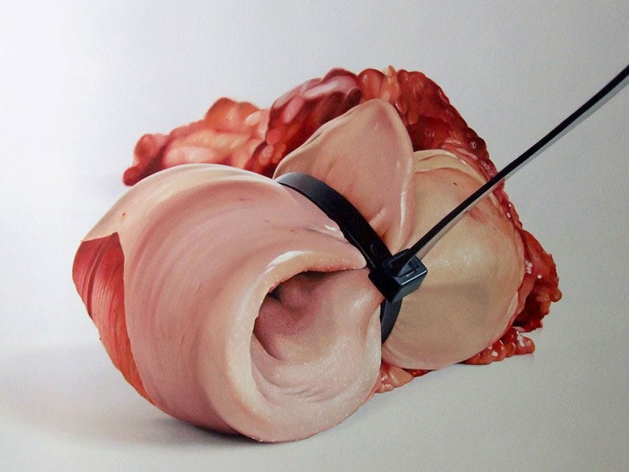 Artwork Title: undefined
