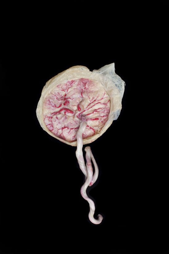 Artwork Title: Untitled 9 (Present Life)