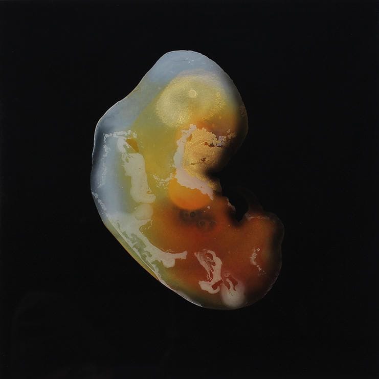 Artwork Title: Study