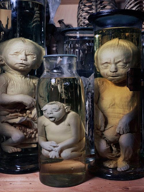 Artwork Title: Preparations of fetuses with inborn navel rapture (1899)