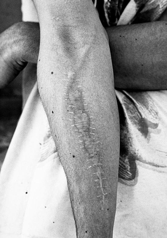 Artwork Title: Metal Veins