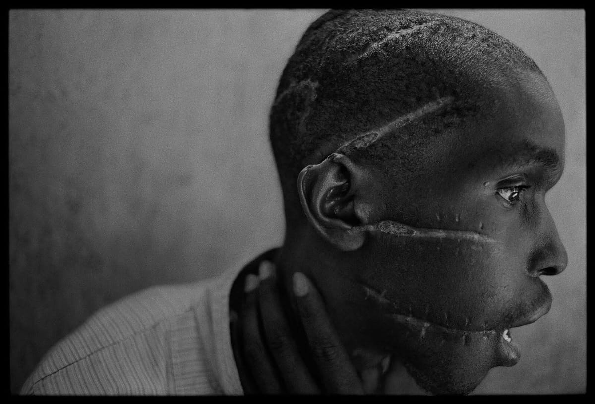 Artwork Title: Scarred