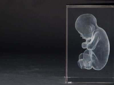 Artwork Title: Hollow foetus