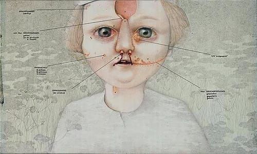 Artwork Title: Gemeines Kind (Mean Child)