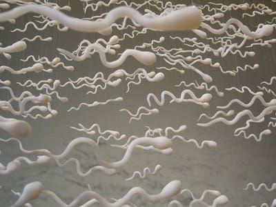 Artwork Title: Spermatozoides