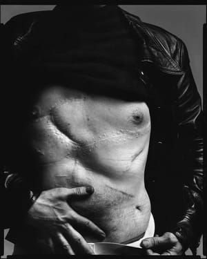 Artwork Title: Andy Warhol (scars), NY