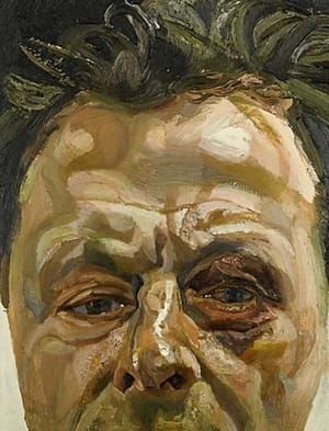 Artwork Title: Self Portrait with Black Eye