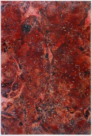 Artwork Title: Biopsy Paintings: Malignant Testicle Tumour