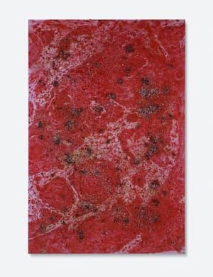 Artwork Title: Biopsy Paintings: Skin Cancer