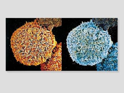 Artwork Title: Biopsy Paintings: Second Series Biopsy