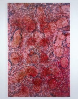 Artwork Title: Biopsy Paintings: Feminizing Testicle