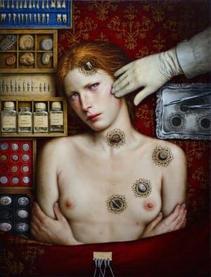 Artwork Title: Nevus