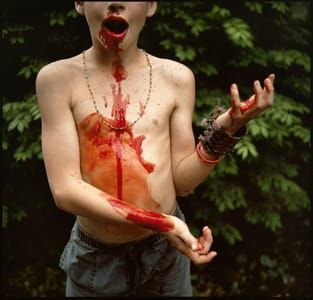 Artwork Title: Bloody Nose