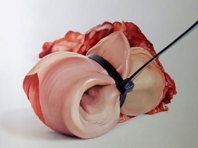 Artwork Title: Untitled