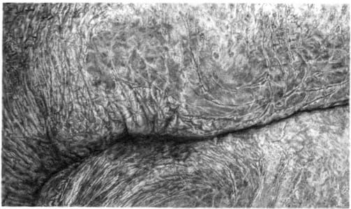 Artwork Title: Crop3YCmouth