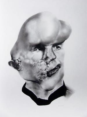 Artwork Title: The Elephant Man (Joseph Merrick)