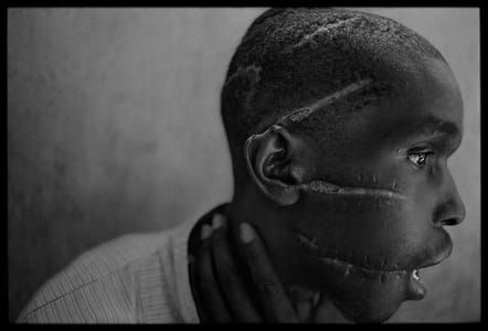 Artwork Title: Scarred